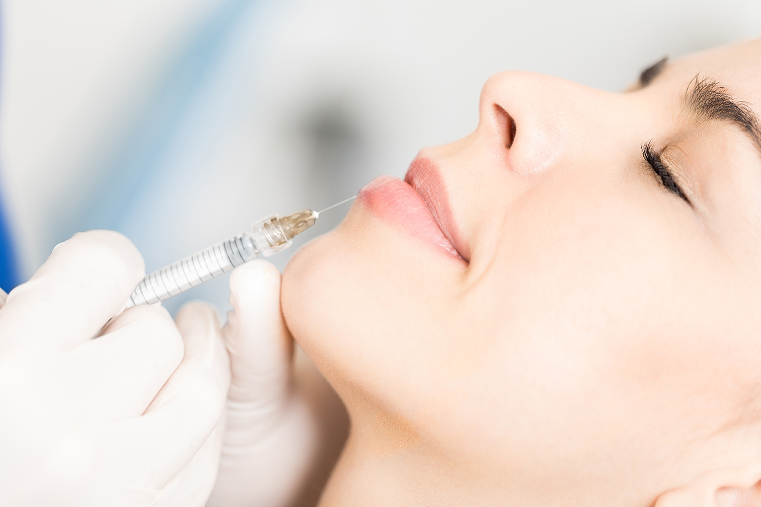 injection-levres-acide-hyaluronique