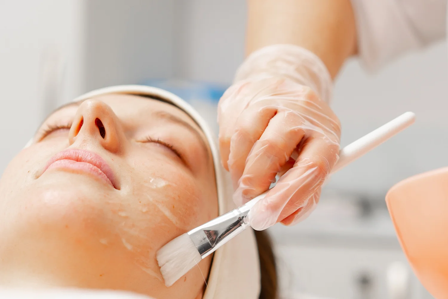 Peeling superficiel visage Nice