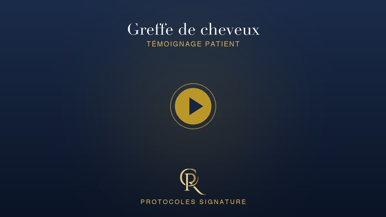 Greffe de cheveux — témoignage